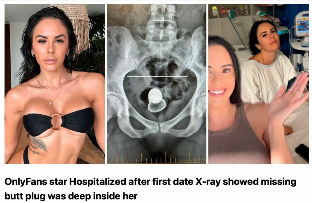 only-fans-star-hospitalized-after-rough-sex-on-the-first-date-x-rays-show-miss-butt-plug-dee-inside-her